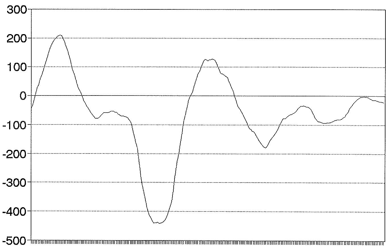 PRIMA DE RIESGO 90 / 180 DIAS
Medias móviles de 25 obs. GRAFICO 5